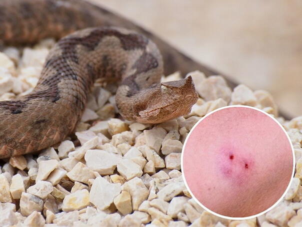 Ugriz zmije u BiH: Znate li kako pružiti prvu pomoć i šta nikako ne smijete raditi?