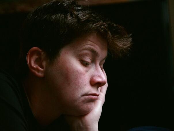 Holesterol visi na vašem licu: Neobičan znak koji upućuje na ozbiljan problem