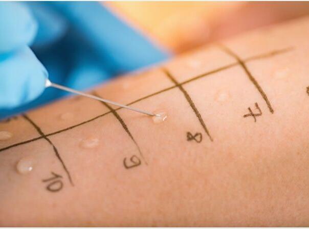 Kad hrana izazove problem: Alergija na hranu kod djece