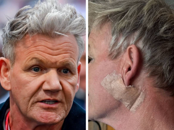 Gordon Ramsay nakon operacije: “Uklonili su mi karcinom”