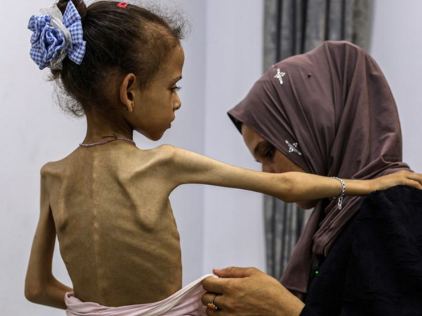 Još osam ljudi umrlo od gladi u Gazi pod izraelskom blokadom